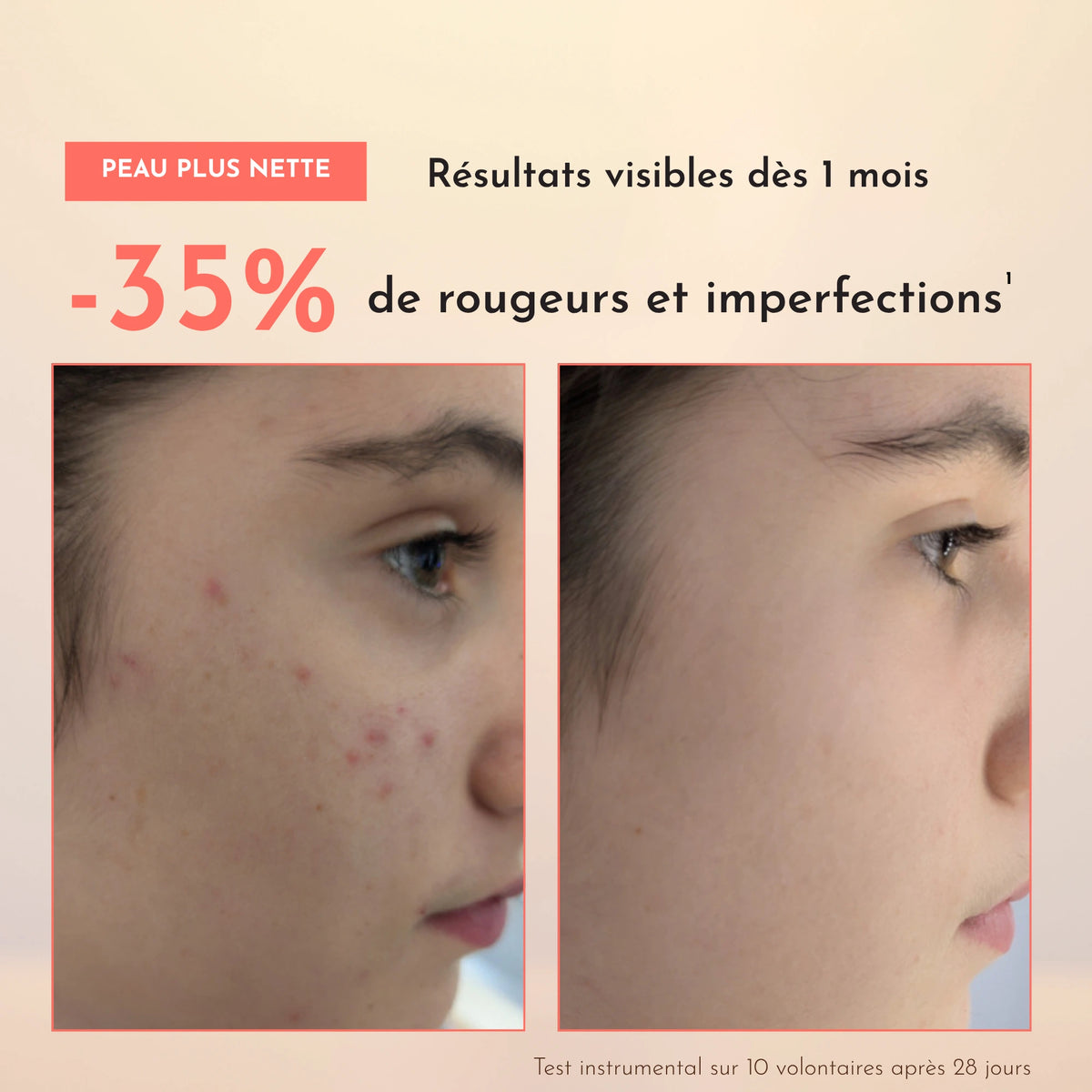 Rituel Anti-Imperfections
