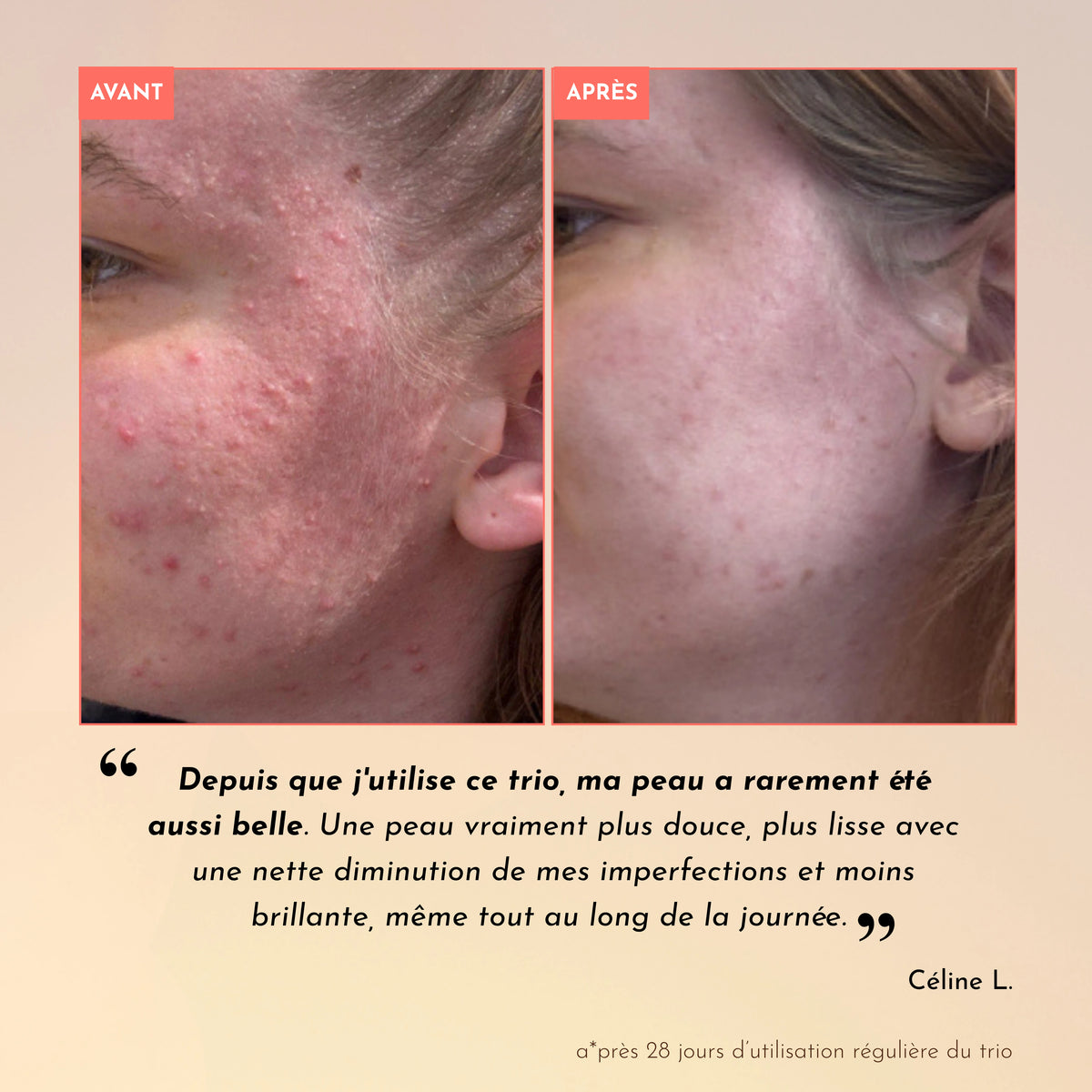 Rituel Anti-Imperfections