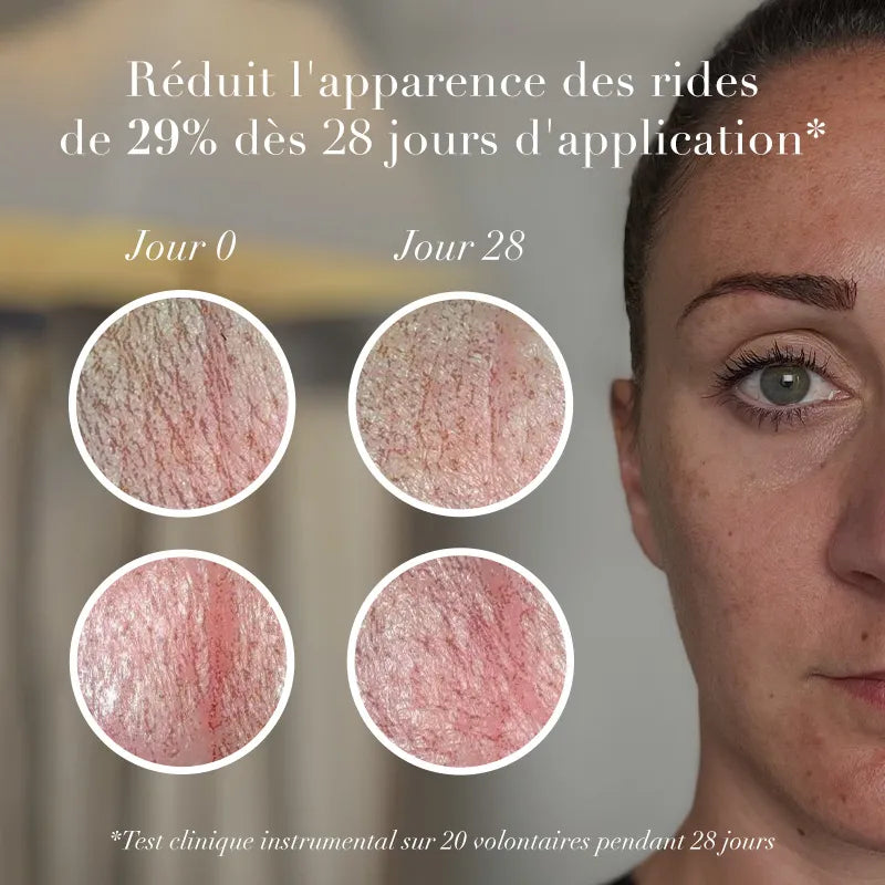 avant après sérum rides