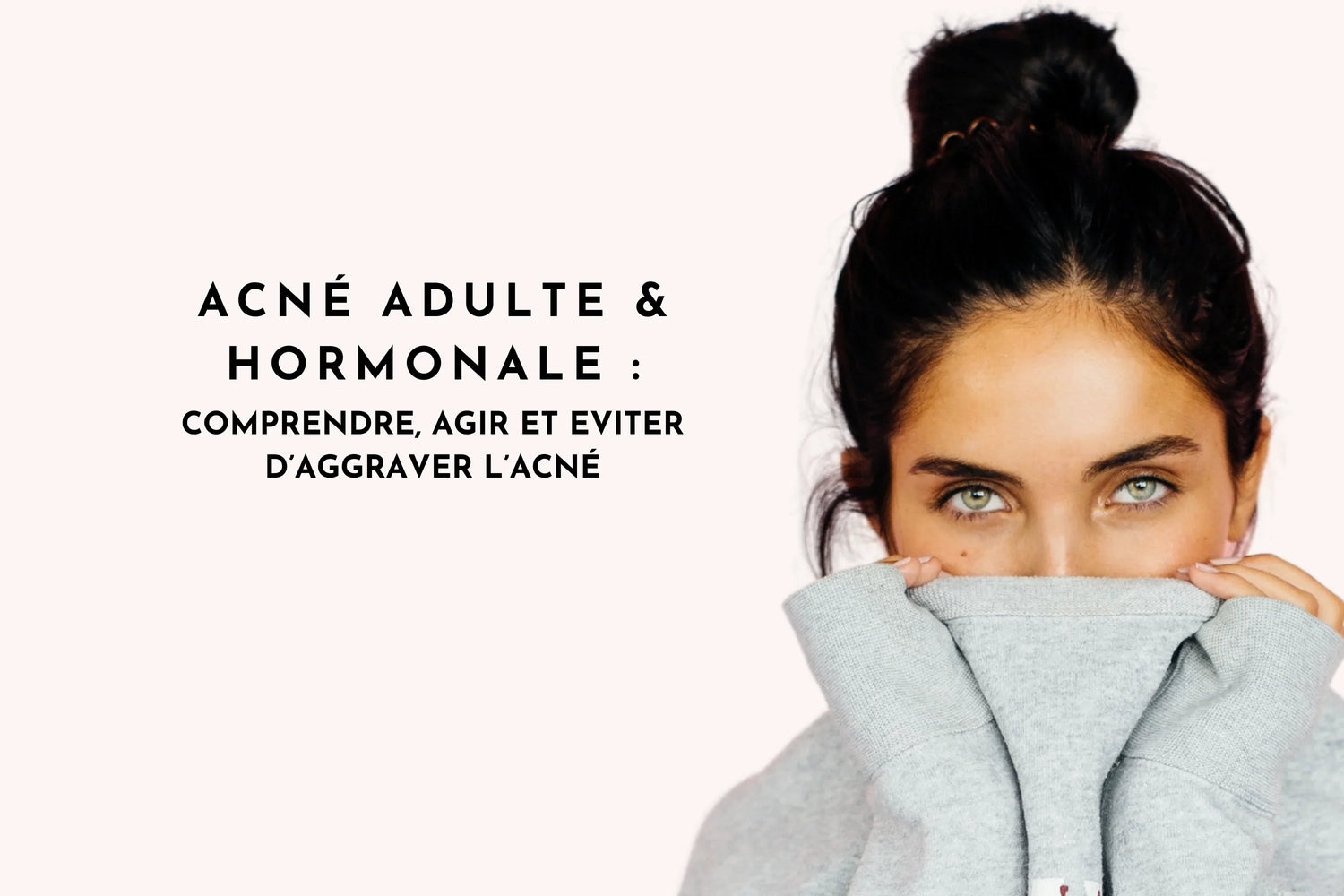 Acné adulte et hormonale : comprendre, agir et éviter d’aggraver l’acné
