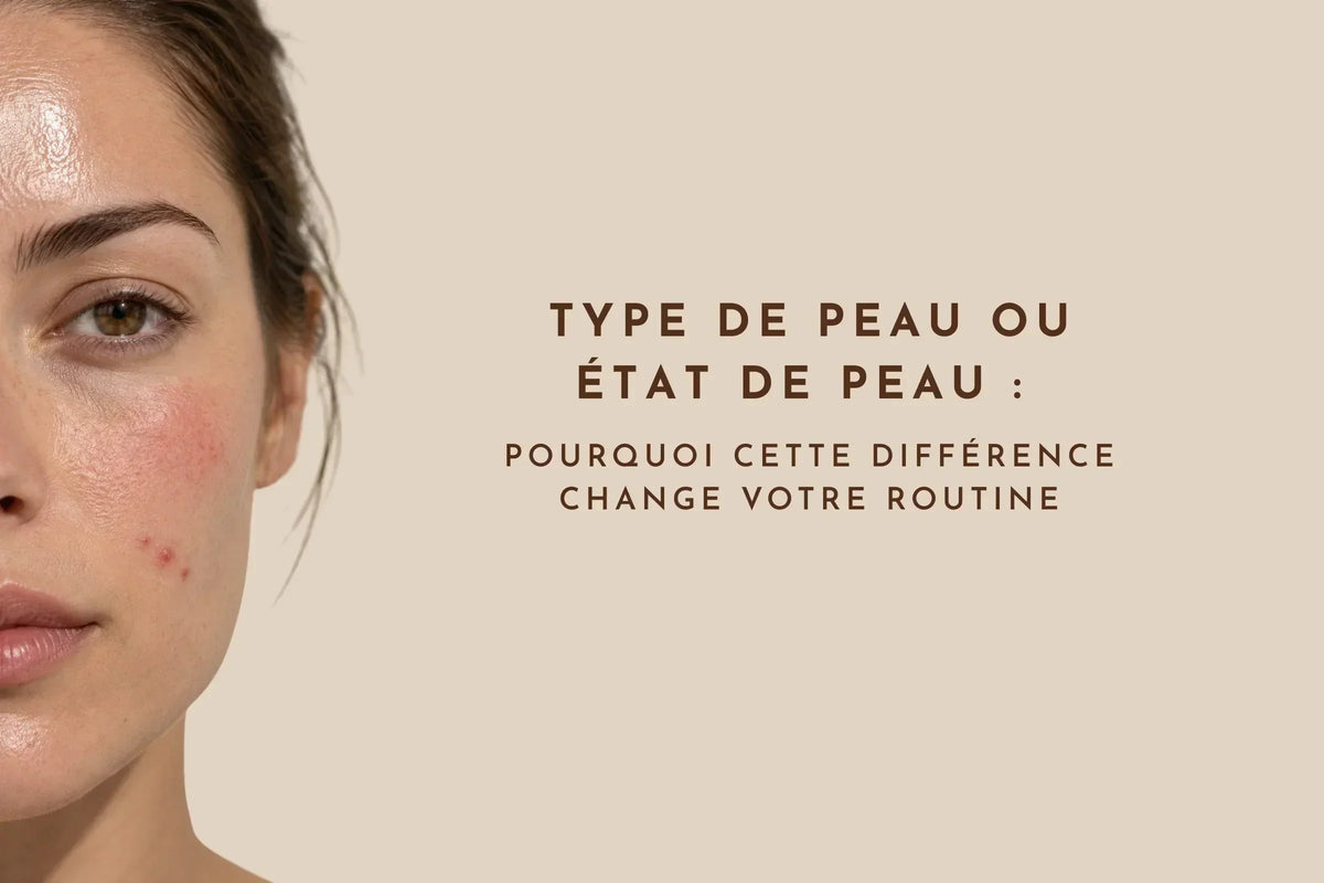 Type de peau ou état de peau : pourquoi cette différence change votre routine