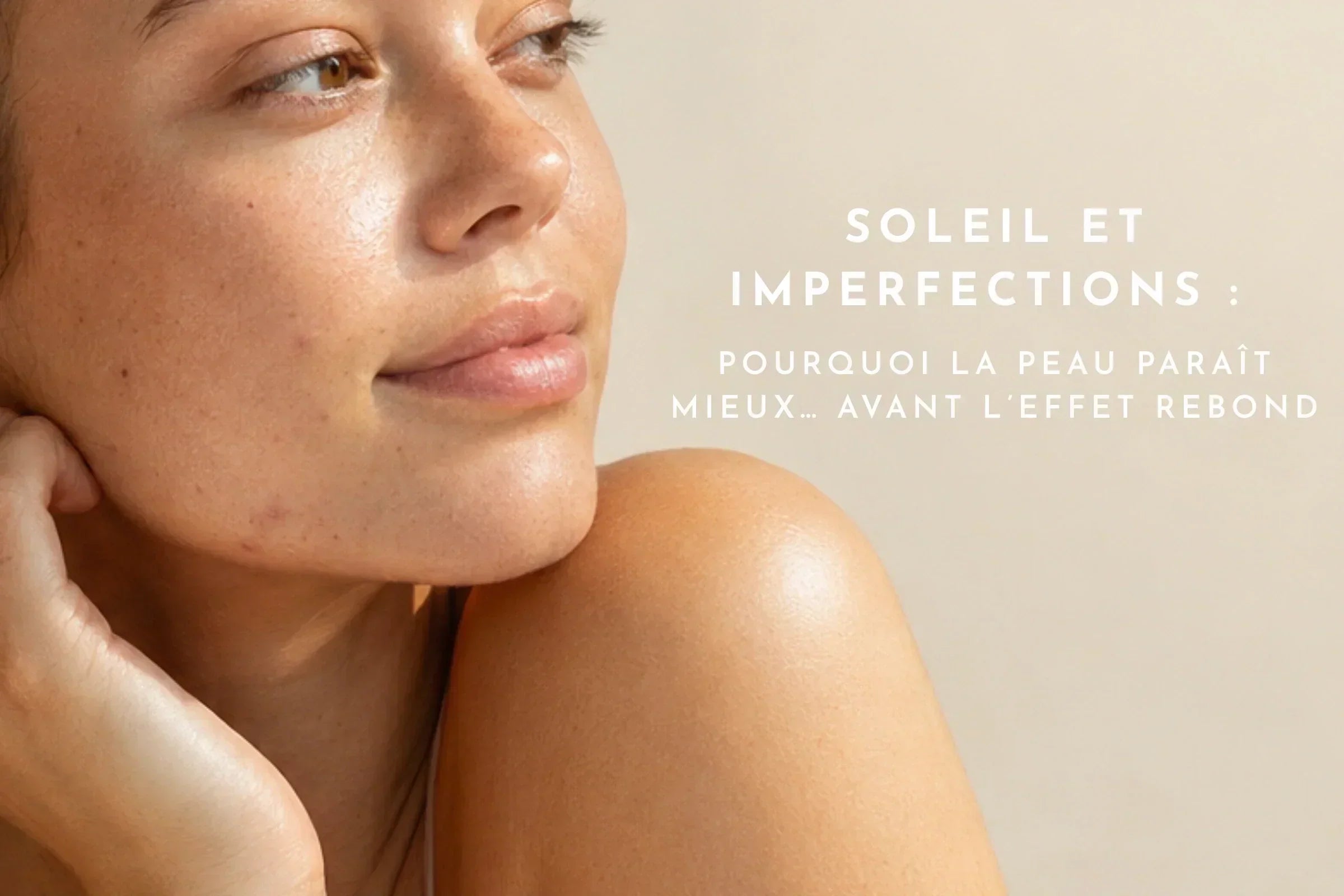 Soleil et imperfections : pourquoi la peau paraît mieux… avant l’effet rebond