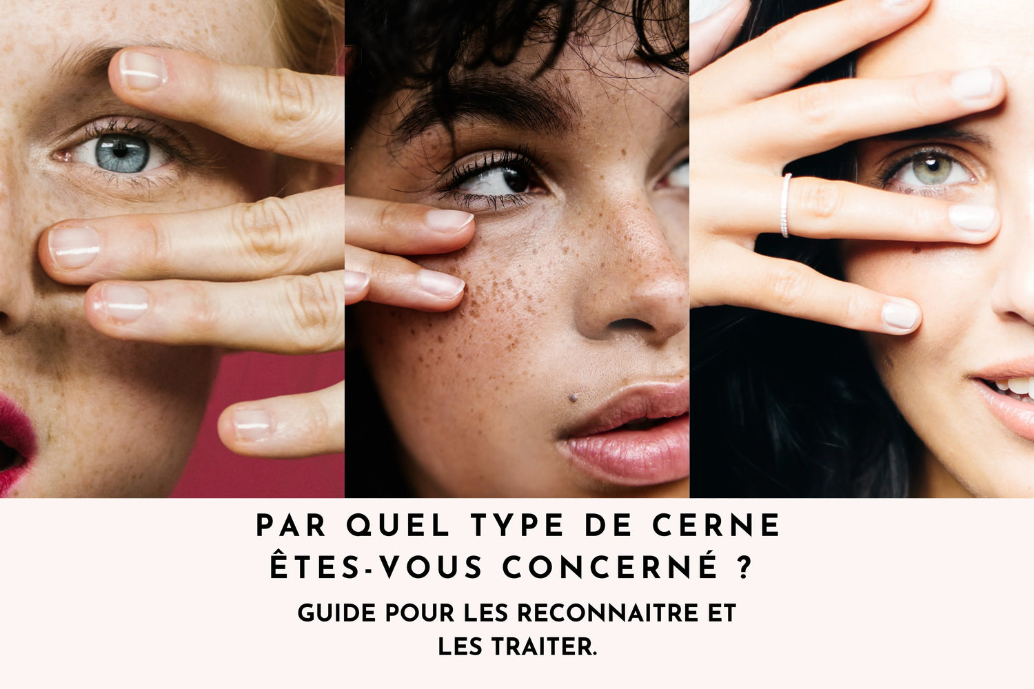 Par quel type de cernes êtes-vous concerné ? Guide pour les reconnaître et les traiter