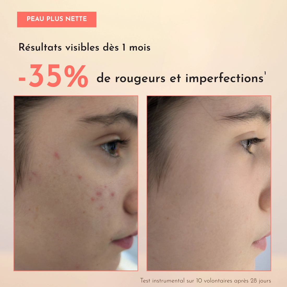 Rituel Anti-Imperfections