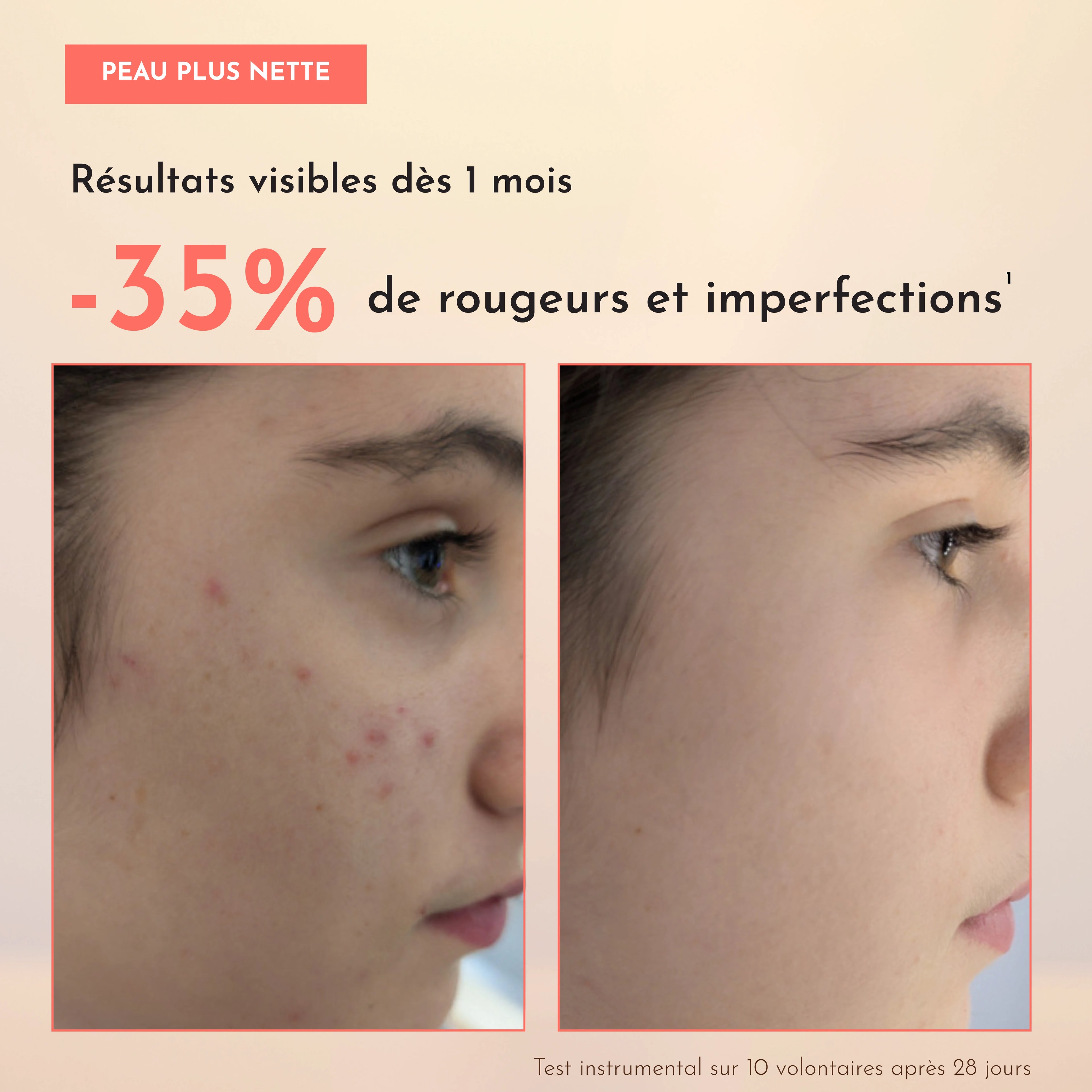 Rituel Anti-Imperfections