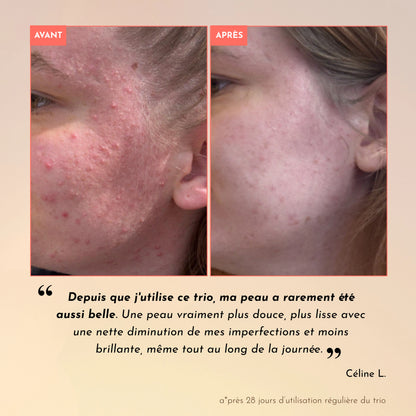 Rituel Anti-Imperfections